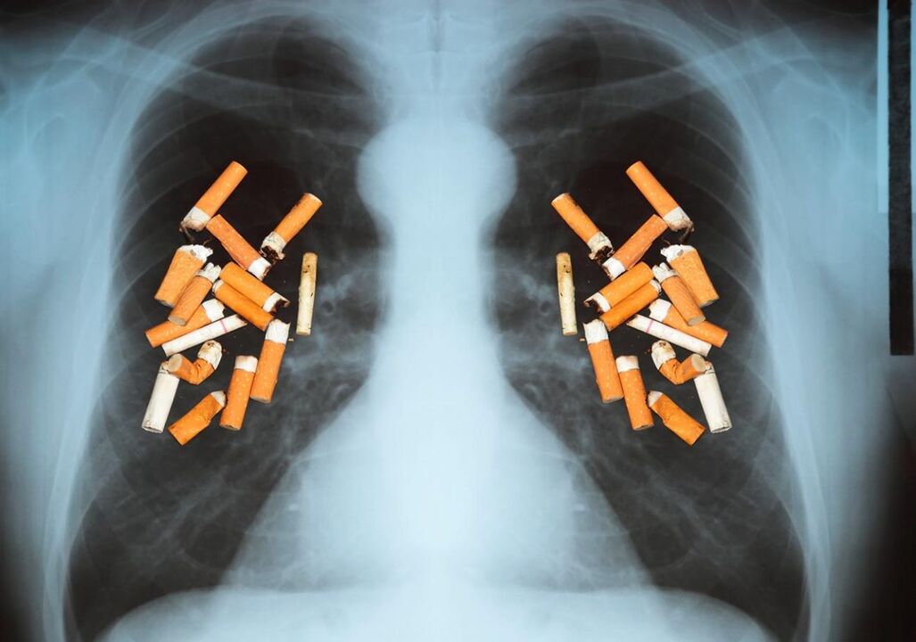 Como os cigarros afetam os pulmões